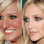 アシュリー・シンプソンの整形が大成功だった祝福!